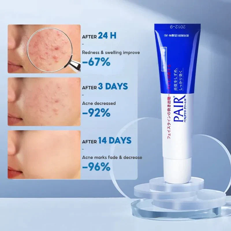 Pair Acne Cream W - Image 5